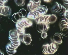 Blutprobe ohne - Amanda Energieprodukte: Bluttest mit Dunkelfeldmikroskopie - Amanda Energieprodukte, Amulett, Bodenbelebung, Depression, Der richtige Platz, dowsing, earth rays, electromagnetic stress, Elektrosmog, Energiesysteme,Energietechnik,energy products, entstören, Entstörung, Erdstrahlen, Erdstrahlung, Erschöpfung, fatigue, Feng Shui, Geomantie, geopathic stress, Hautkrankheit, Hautproblem, Hyperaktivität, insomnia, Kinderlosigkeit, Kopfschmerzen, Kraftort, Kraftplatz, Lichtenergie, Medaillon, Migräne, Müdigkeit, Nervosität, Neurodermitis, Orgon, Ort der Kraft, Pendel, pendeln, place of power, Psoriasis, pyramid, Pyramide, Radiästhesie, Resonanz-Technologie, Rückenschmerzen, Rute, Rutengehen, Schlaflosigkeit, Schlafplatzuntersuch, Schlafstörungen, Schmerzen, Standortbelastung, Stoffwechselstörungen, Tachionen, Tachyon, Tschopp, Umweltverschmutzung, Unterleibsbeschwerden, Verdauungsproblem, Verspannungen, vitalisation, vitaliser, vitalisieren, Wasser, Wasserader, Wasseradern, Wasseraktivierung, Wasserbelebung, Wasserqualität, Wassertherapie, Wasservitalisierung, water, Wünschelrute, LIEBE, DANKBARKEIT