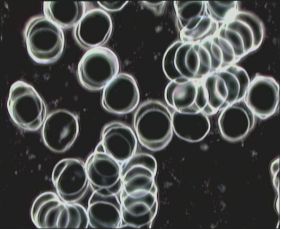 Blutprobe mit - Amanda Energieprodukte: Bluttest mit Dunkelfeldmikroskopie - Amanda Energieprodukte, Amulett, Bodenbelebung, Depression, Der richtige Platz, dowsing, earth rays, electromagnetic stress, Elektrosmog, Energiesysteme,Energietechnik,energy products, entstören, Entstörung, Erdstrahlen, Erdstrahlung, Erschöpfung, fatigue, Feng Shui, Geomantie, geopathic stress, Hautkrankheit, Hautproblem, Hyperaktivität, insomnia, Kinderlosigkeit, Kopfschmerzen, Kraftort, Kraftplatz, Lichtenergie, Medaillon, Migräne, Müdigkeit, Nervosität, Neurodermitis, Orgon, Ort der Kraft, Pendel, pendeln, place of power, Psoriasis, pyramid, Pyramide, Radiästhesie, Resonanz-Technologie, Rückenschmerzen, Rute, Rutengehen, Schlaflosigkeit, Schlafplatzuntersuch, Schlafstörungen, Schmerzen, Standortbelastung, Stoffwechselstörungen, Tachionen, Tachyon, Tschopp, Umweltverschmutzung, Unterleibsbeschwerden, Verdauungsproblem, Verspannungen, vitalisation, vitaliser, vitalisieren, Wasser, Wasserader, Wasseradern, Wasseraktivierung, Wasserbelebung, Wasserqualität, Wassertherapie, Wasservitalisierung, water, Wünschelrute, LIEBE, DANKBARKEIT